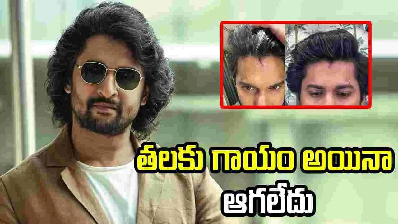 Nani Head Injury: నాని తలకు గాయం.. అయినా షూటింగ్ ఆపలేదు.. 