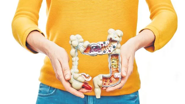 Colon Cancer Alert: పెద్దపేగు పదిలంగా 