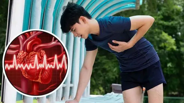 Youth Heart Attack: యువతలో పెరుగుతున్న గుండెపోటు కేసులు.. కారణాలివే.. తప్పక తెలుసుకోండి..