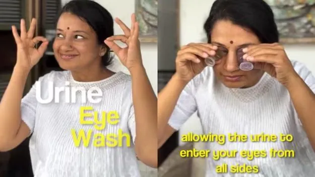 Urine Eye Wash: ఇదేం చికిత్స తల్లీ.. కళ్లను మూత్రంతో శుభ్రం చేసుకుంటున్న మహిళ