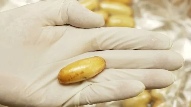 Mumbai: ప్రయాణికుడి పొట్టలో 67 కొకైన్‌ క్యాప్సూల్స్‌