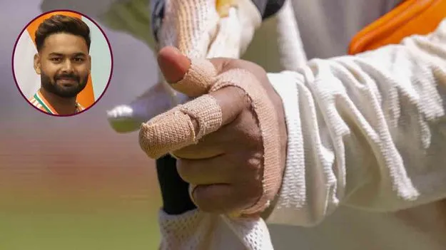 Rishabh Pant Injured: పంత్‌కు గాయం