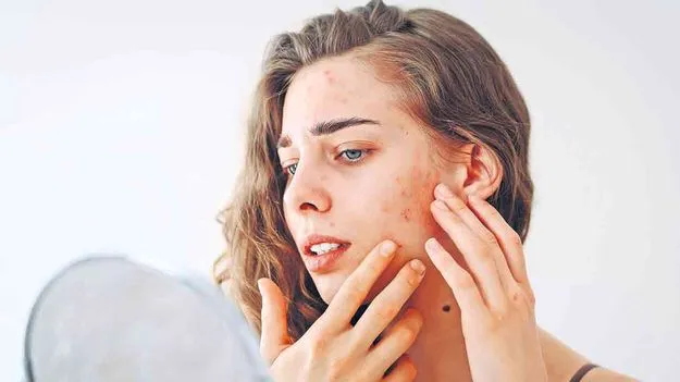 పిగ్మెంటేషన్‌ తగ్గిద్దామిలా