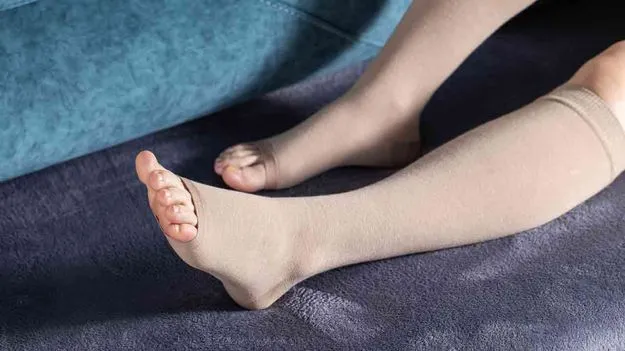 లింఫొడీమా ఎందుకు