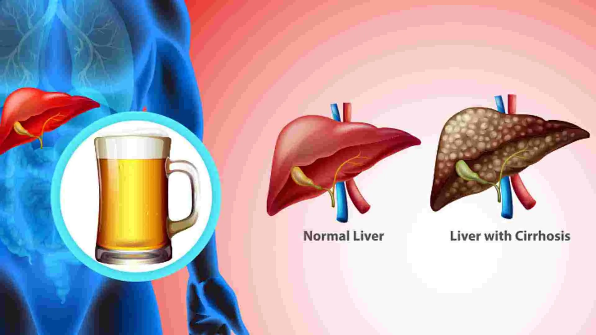 Liver Health Tips: ఈ 4 లక్షణాలు కనిపిస్తున్నాయా.. అయితే మీ కాలేయం ప్రమాదంలో పడ్డట్లే..