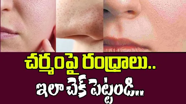 ఇలా చేస్తే చర్మ రంధ్రాలు కనిపించవు