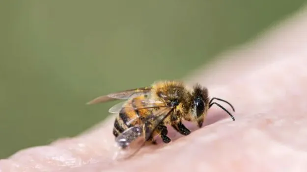 Bee Bite Home Remedy: తేనెటీగ కుట్టిందని బాధపడుతున్నారా? ఈ నేచురల్ రెమెడీస్ ట్రై చేయండి!