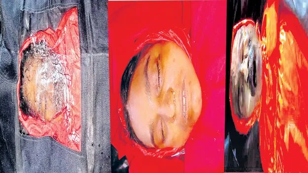 Bodies of Maoist Leaders: గాజర్ల రవి భౌతికకాయం అప్పగింత