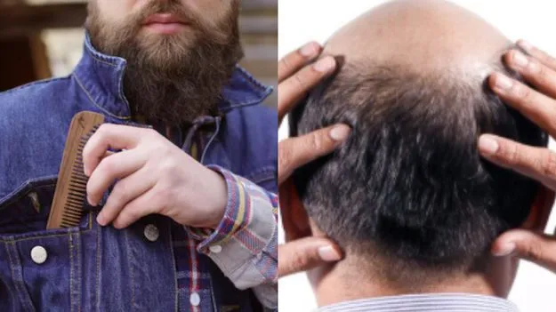 Combing Hair Repeatedly:  పదే పదే జుట్టు దువ్వడం వల్ల పురుషులకు బట్టతల వస్తుందా?