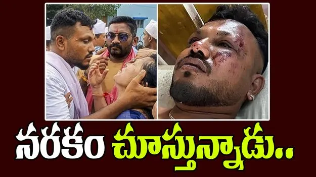 Ahmedabad Crash Survivor:  విమాన ప్రమాదం.. బతికినా నరకం తప్పటం లేదు.. 