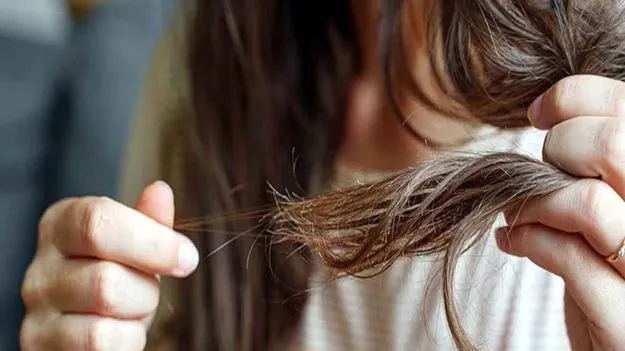 Hair Friendly Foods: రోజుకు ఇవి ఓ స్పూన్ తింటే చాలు జుట్టు రాలే సమస్య మాయం!