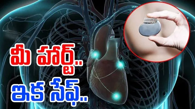 శరీరంలో కరిగిపోయే పేస్ మేకర్