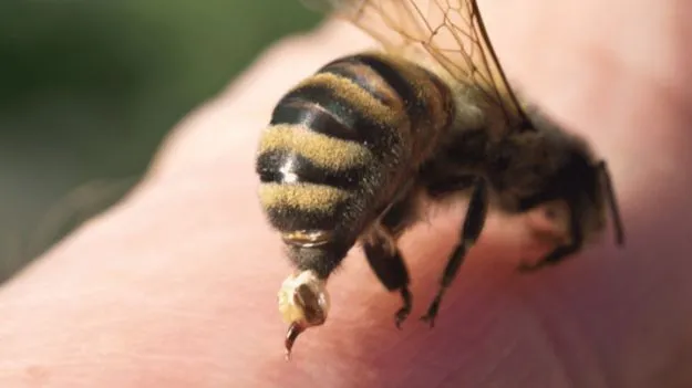 Honey Bee venom: తేనెటీగల విషం రొమ్ము క్యాన్సర్కు ఔషధంగా పనిచేస్తుందా? తాజా అధ్యయనంలో సంచలన విషయాలు.!