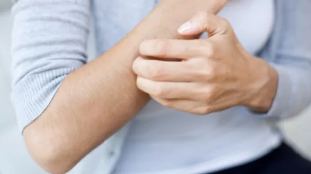 Home Remedies for Itching: దురదతో ఇబ్బంది పడుతున్నారా? ఈ 5 సహజ చిట్కాలు మీకోసమే!