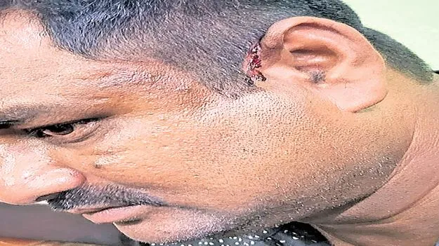 Mulugu: ఆంధ్రజ్యోతి విలేకరిపై హత్యాయత్నం