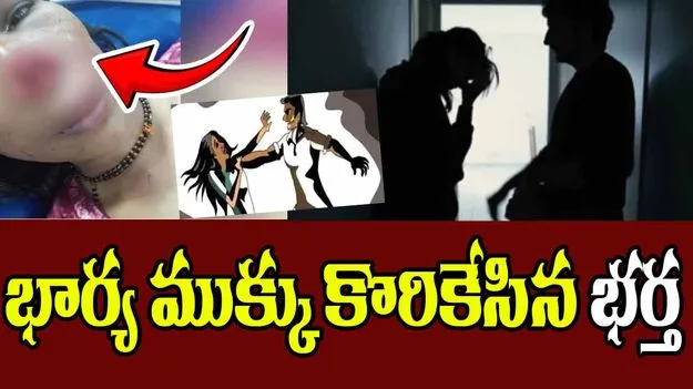 Man Bites Wife's Nose: అప్పు గొడవ.. భార్య ముక్కు కొరికేసిన భర్త