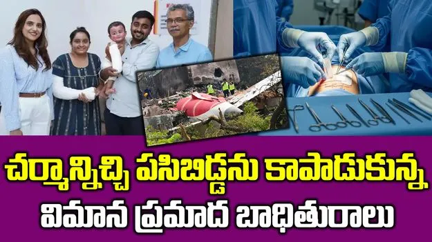 Mothers Skin Grafts:  తన చర్మాన్నేబిడ్డకు కవచంగా.. ఓ తల్లి వీరోచిత పోరాటం
