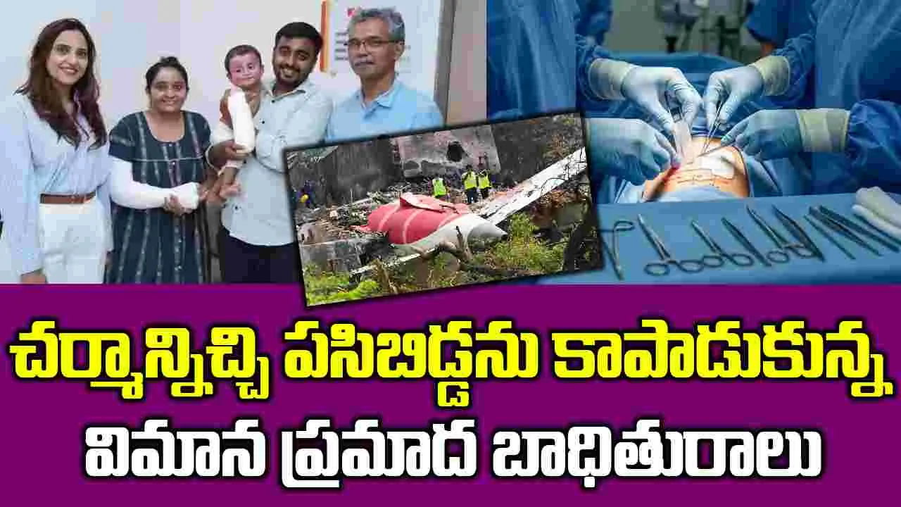 Mothers Skin Grafts:  తన చర్మాన్నేబిడ్డకు కవచంగా.. ఓ తల్లి వీరోచిత పోరాటం