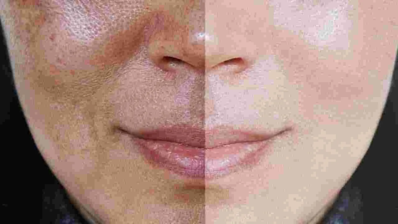 Beauty Tips: ముఖానికి కలబంద రాసుకుంటున్నారా.. అయితే ఈ తప్పులు అస్సలు చేయకండి.. 