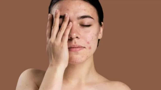 Beauty Tips: చర్మంపై మచ్చలతో బాధపడుతున్నారా.. ఈ కూరగాయ రసంతో  చెక్ పెట్టండి..