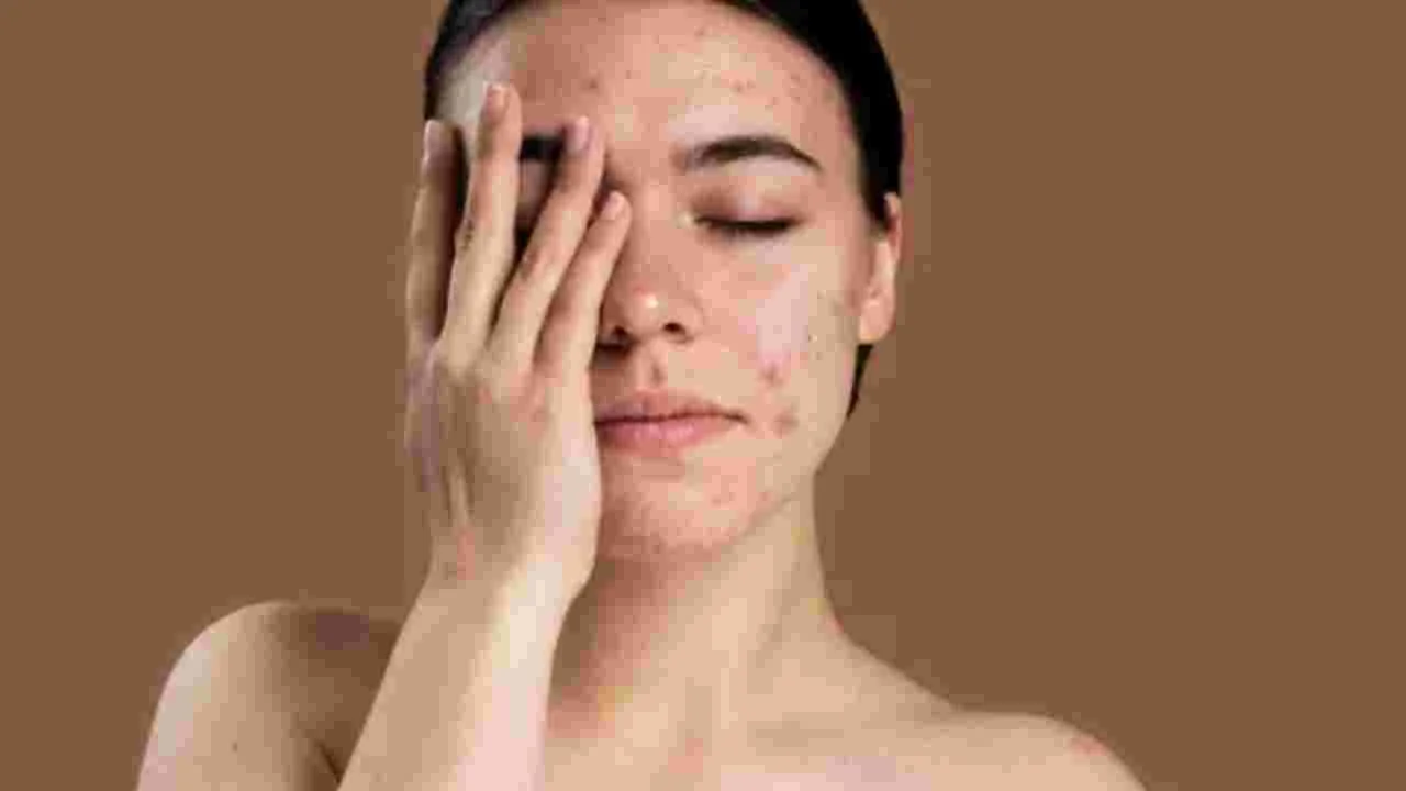 Beauty Tips: చర్మంపై మచ్చలతో బాధపడుతున్నారా.. ఈ కూరగాయ రసంతో  చెక్ పెట్టండి..