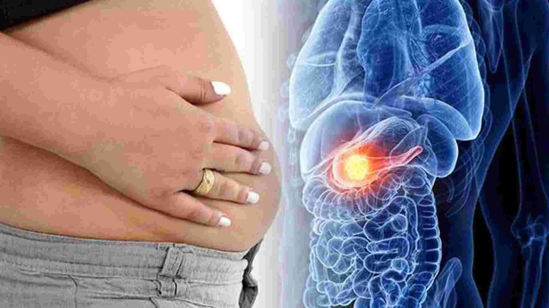 Liver Health Tips: ఈ 4 లక్షణాలు కనిపిస్తున్నాయా.. అయితే మీ కాలేయం ప్రమాదంలో పడ్డట్లే..