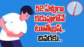 Toothbrush in stomach: షాకింగ్.. 52 ఏళ్లుగా కడుపులోనే టూత్‌బ్రష్.. చివరకు అతడి పరిస్థితి ఏమైందంటే..
