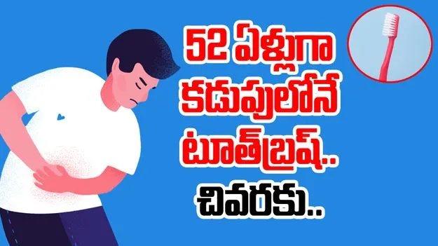 Toothbrush in stomach: షాకింగ్.. 52 ఏళ్లుగా కడుపులోనే టూత్‌బ్రష్.. చివరకు అతడి పరిస్థితి ఏమైందంటే..