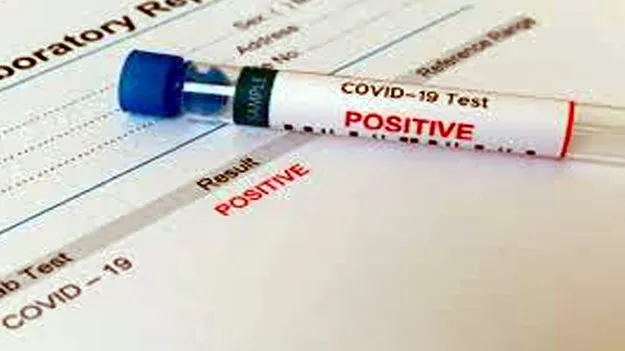 Covid 19 Positive: గుంటూరులో రెండు కొవిడ్ కేసులు