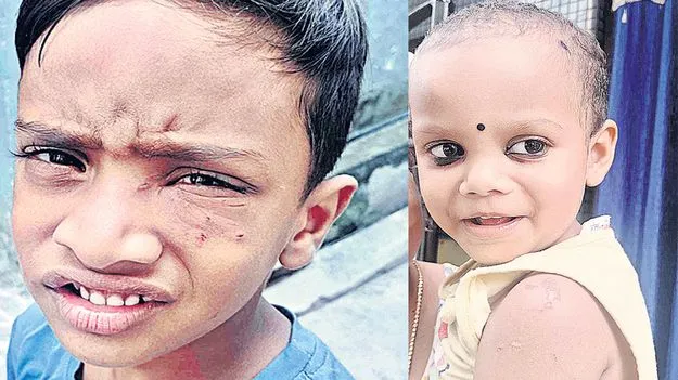 వీధి కుక్క దాడి: 8 మంది చిన్నారులకు గాయాలు