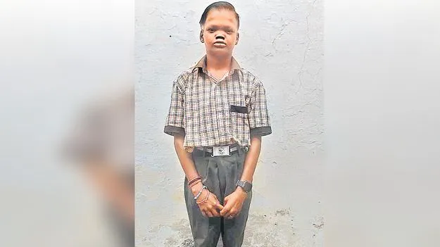 Free Medical Help: కొత్తచెరువు విద్యార్థికి వైద్య సాయం