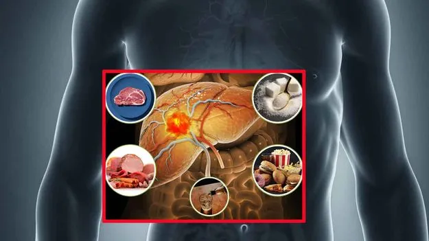 Liver Damaging Foods: ఈ 5 ఆహారాలు 'యాసిడ్' కంటే తక్కువ కాదు.. రోజూ తింటే లివర్ క్యాన్సర్..!