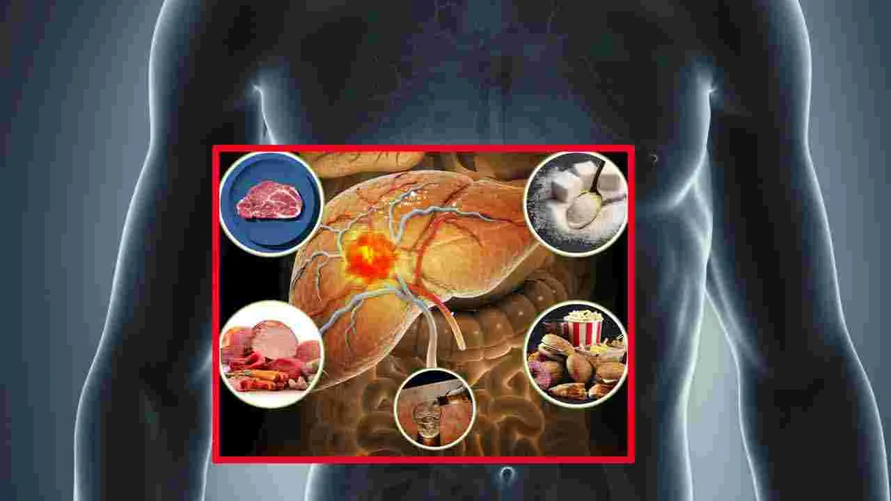 Liver Damaging Foods: ఈ 5 ఆహారాలు 'యాసిడ్' కంటే తక్కువ కాదు.. రోజూ తింటే లివర్ క్యాన్సర్..!