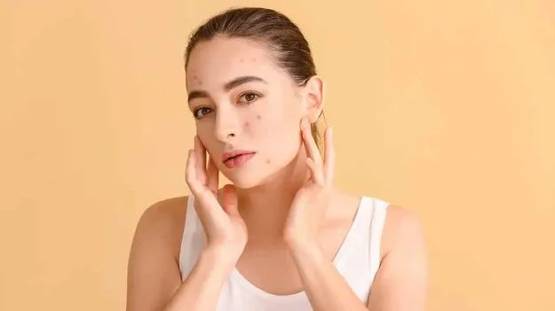 Skin Care:  ఈ 5 అలవాట్లతో వర్షాకాలంలో స్కిన్ అలెర్జీలు..