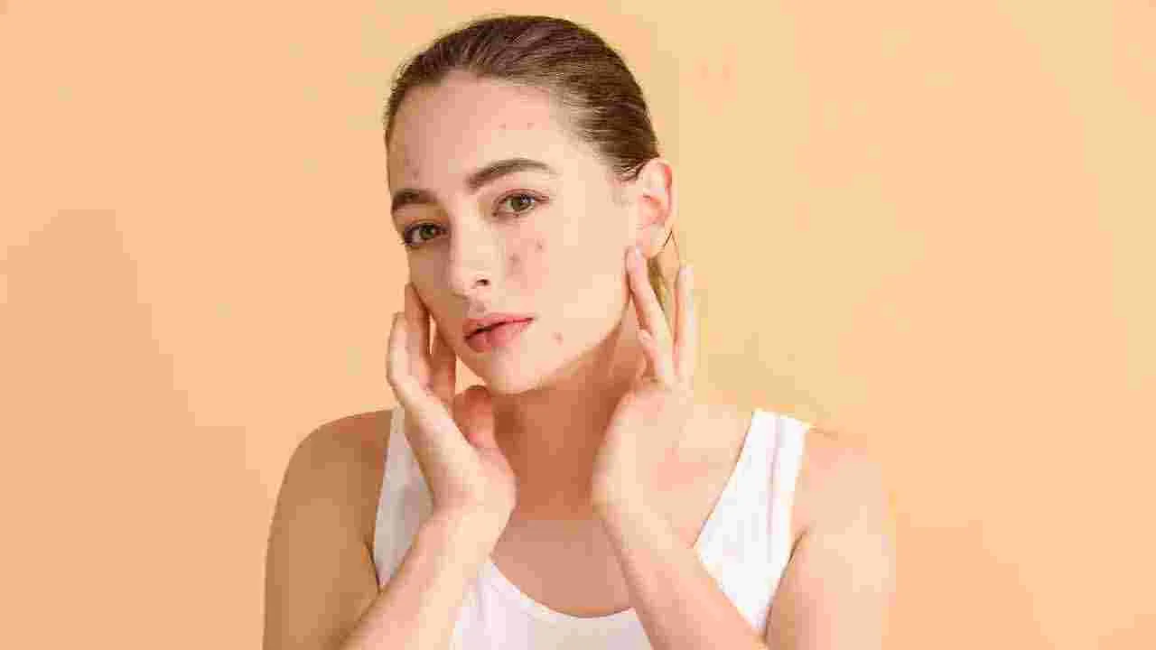 Skin Care:  ఈ 5 అలవాట్లతో వర్షాకాలంలో స్కిన్ అలెర్జీలు..