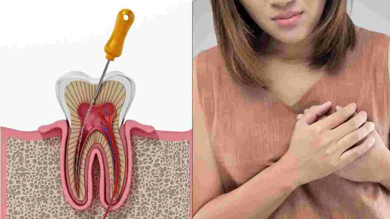 Root Canal Heart Link: రూట్ కెనాల్ చేస్తే వీరికి హార్ట్ అటాక్ ముప్పు? తాజా పరిశోధనలో సంచలన నిజాలు..!