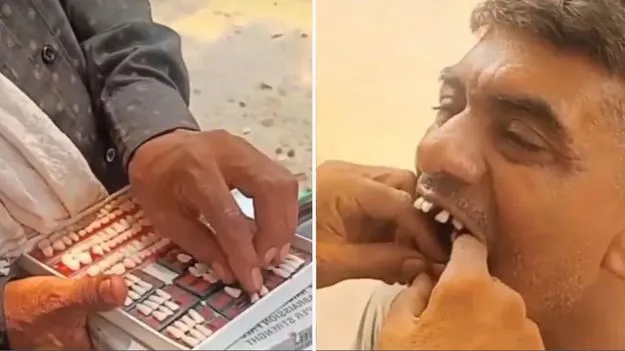 Viral Video: ఇతడిని చూస్తే డాక్టర్లే భయపడతారేమో.. క్షణాల్లో దంతాన్ని ఎలా సెట్ చేశాడో చూడండి.. 