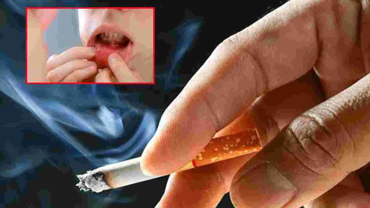 Mouth Cancer: ముఖంలో కనిపించే ఈ చిన్న మార్పే... నోటి క్యాన్సర్‌కు సంకేతమా?