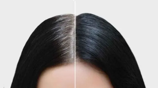 Premature Greying: తెల్ల జుట్టు వస్తోందా? ఆందోళవద్దు.. ఈ సింపుల్ చిట్కాలతో బై బై చెప్పేయండి..!