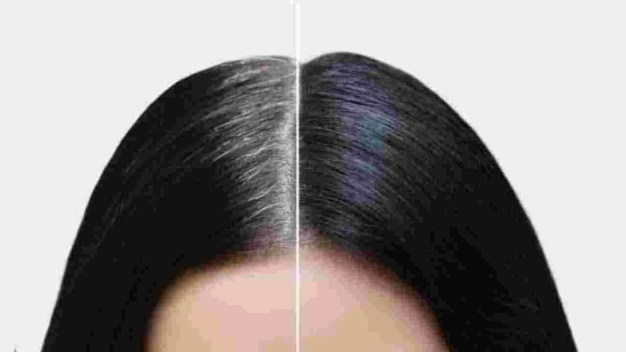 Premature Greying: తెల్ల జుట్టు వస్తోందా? ఆందోళవద్దు.. ఈ సింపుల్ చిట్కాలతో బై బై చెప్పేయండి..!