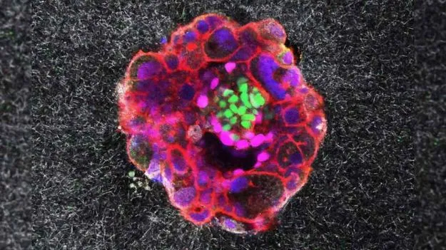 3D Embryo Implantation: వైద్యరంగంలో మరో అద్భుతం.. IVF ప్రాసెస్ త్రీడీలో చిత్రీకరణ..