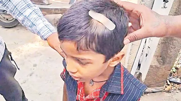 Teacher Misconduct: చిన్నారిపై టీచర్‌ అమానుషం!