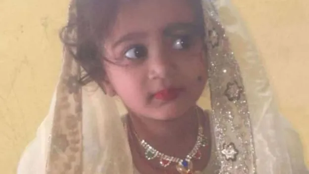 Karnataka Rabies Death: వీధి కుక్క కరవడంతో రేబిస్ వ్యాధి.. కర్ణాటకలో చిన్నారి మృతి