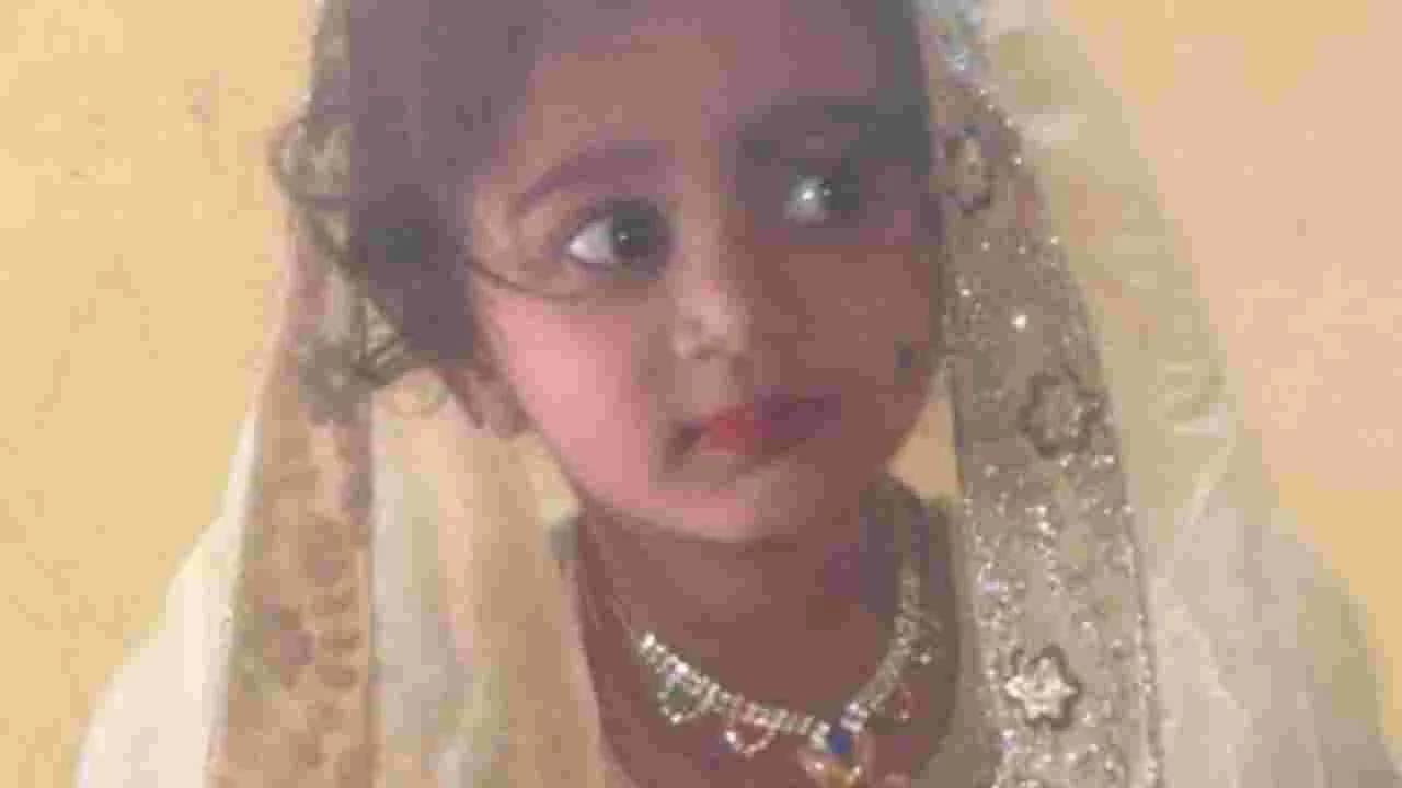 Karnataka Rabies Death: వీధి కుక్క కరవడంతో రేబిస్ వ్యాధి.. కర్ణాటకలో చిన్నారి మృతి