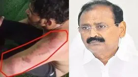 Tirupati YCP Attack On Driver: తిరుపతిలో దళిత డ్రైవర్‌పై దాడి.. పోలీసు శాఖ సీరియస్ 