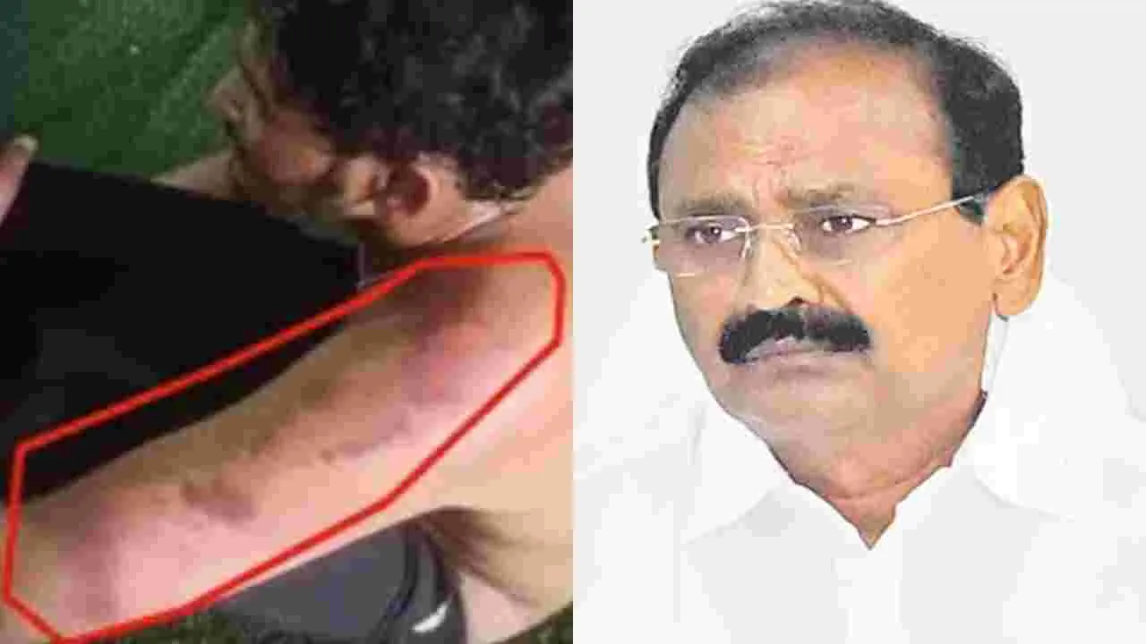 Tirupati YCP Attack On Driver: తిరుపతిలో దళిత డ్రైవర్‌పై దాడి.. పోలీసు శాఖ సీరియస్ 