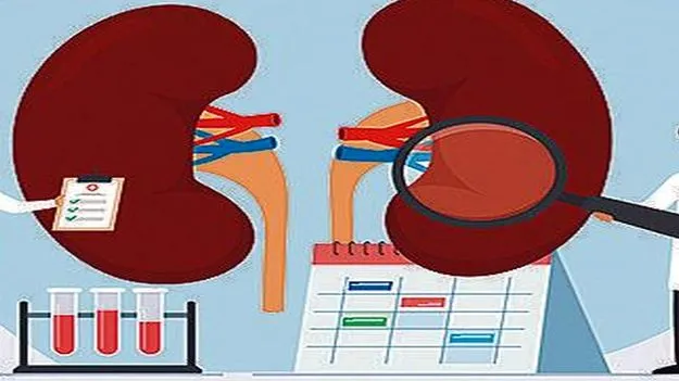 CID: హైదరాబాద్‌ కిడ్నీ రాకెట్‌ కేసులో విశాఖ వైద్యుడు