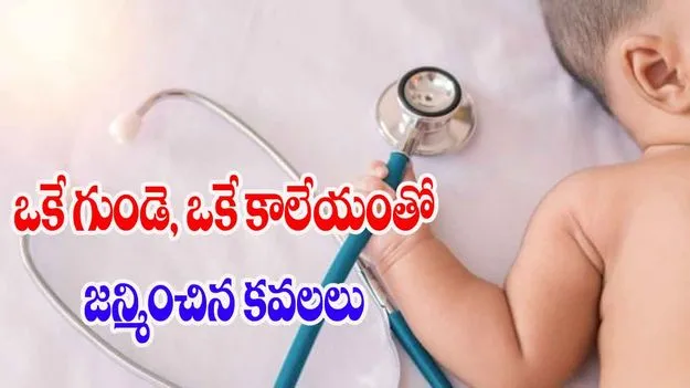 Twins Born One Heart One Liver: ఒకే గుండె, ఒకే కాలేయంతో జన్మించిన కవలలు..24 గంటల్లోనే మృతి, ఎందుకిలా..