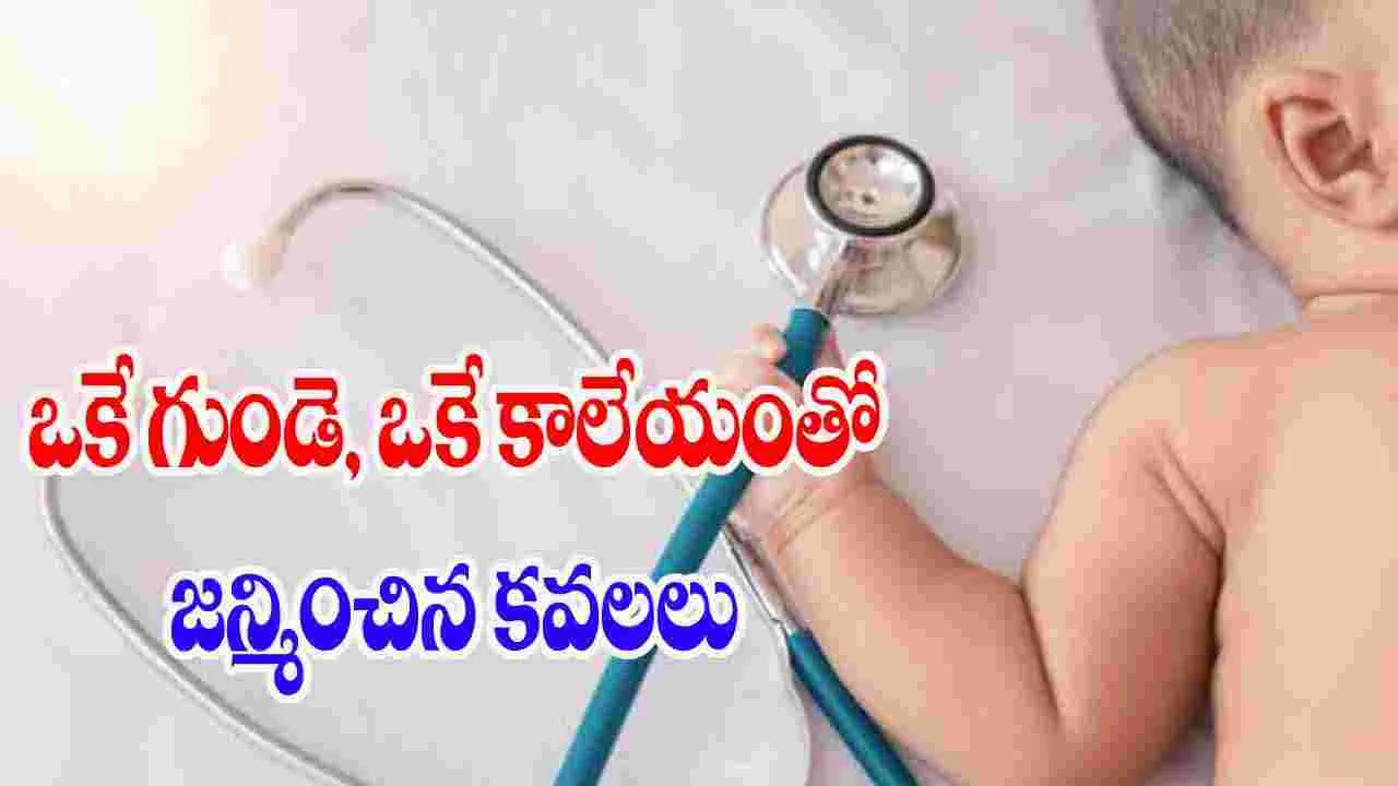 Twins Born One Heart One Liver: ఒకే గుండె, ఒకే కాలేయంతో జన్మించిన కవలలు..24 గంటల్లోనే మృతి, ఎందుకిలా..