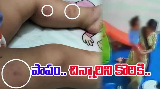 Minor Daycare Attendant: డే కేర్ సెంటర్‌లో దారుణం.. చిన్నారిని చిత్ర హింసలు పెట్టిన మహిళా సిబ్బంది..
